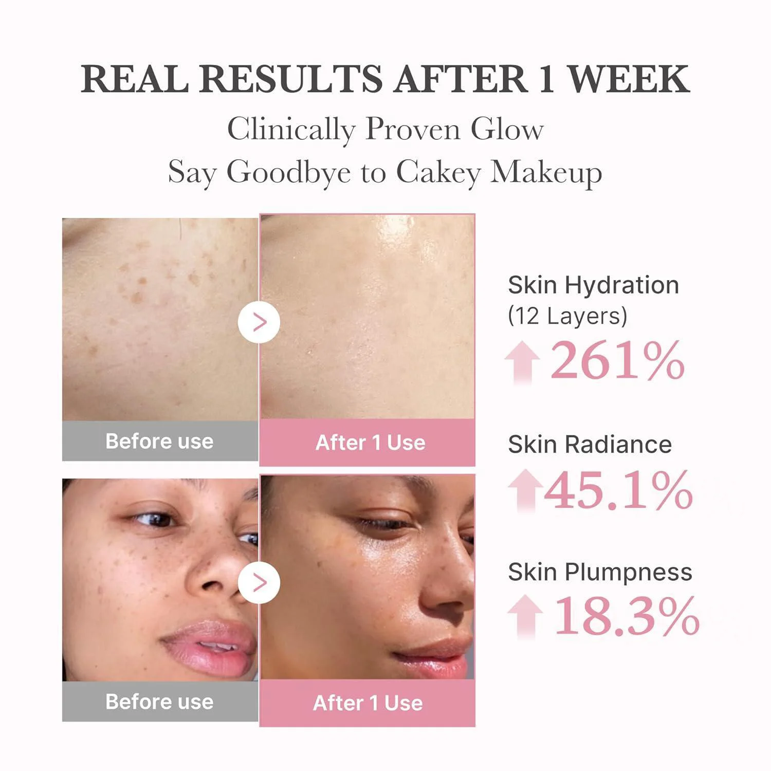 Les résultats sont visibles dès la première semaine avec Medicube Pdrn Pink Sérum Bulle de Collagène Rose Hydratant et Illuminatrice 95 ml. Les gros plans avant-après révèlent une peau plus lisse et plus lumineuse, avec une hydratation augmentée de 261 %, un éclat de 45,1 % et une peau plus rebondie de 18,3 %. Dakar