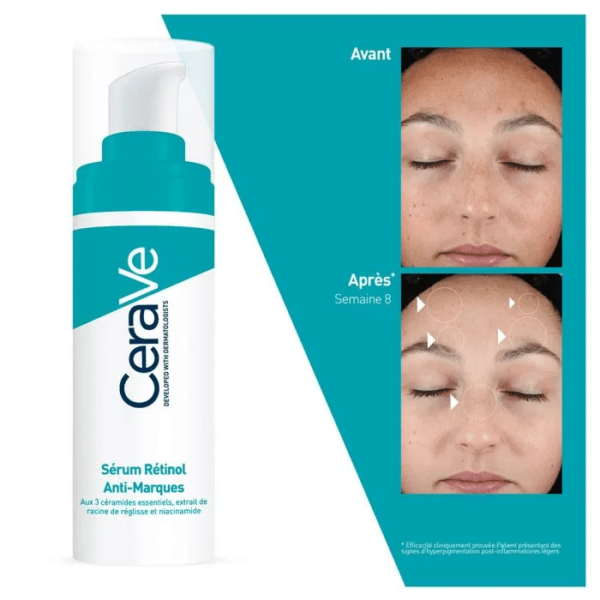 CeraVe Sérum Rétinol Anti-Imperfections Peaux à Imperfections 30 ml – Image 3