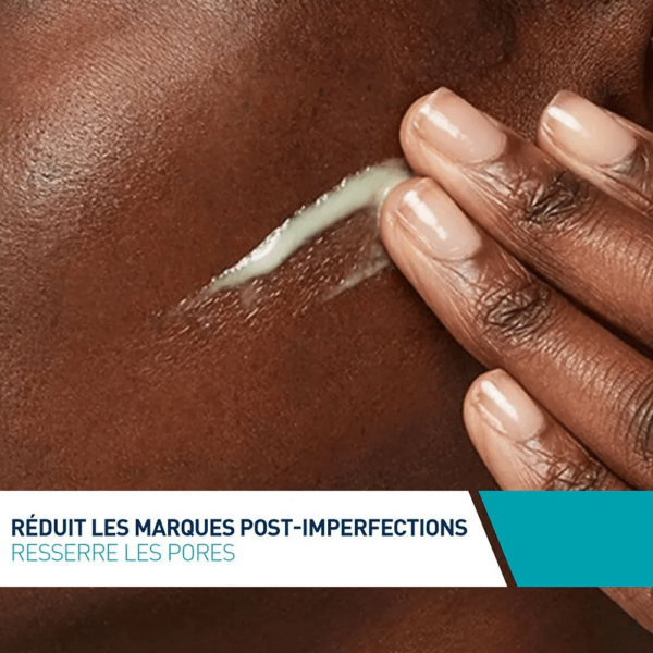 CeraVe Sérum Rétinol Anti-Imperfections Peaux à Imperfections 30 ml – Image 4