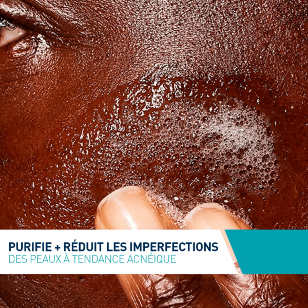CeraVe Gel Moussant Anti-Imperfections Peaux à Tendance Acnéique 236 ml – Image 3