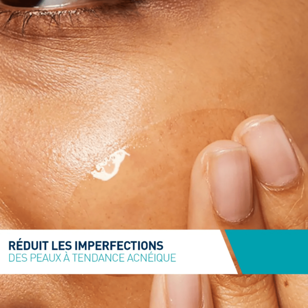 CeraVe Soin Concentré Anti-Imperfections Peaux à Imperfections et Tendance Acnéique 40 ml – Image 2