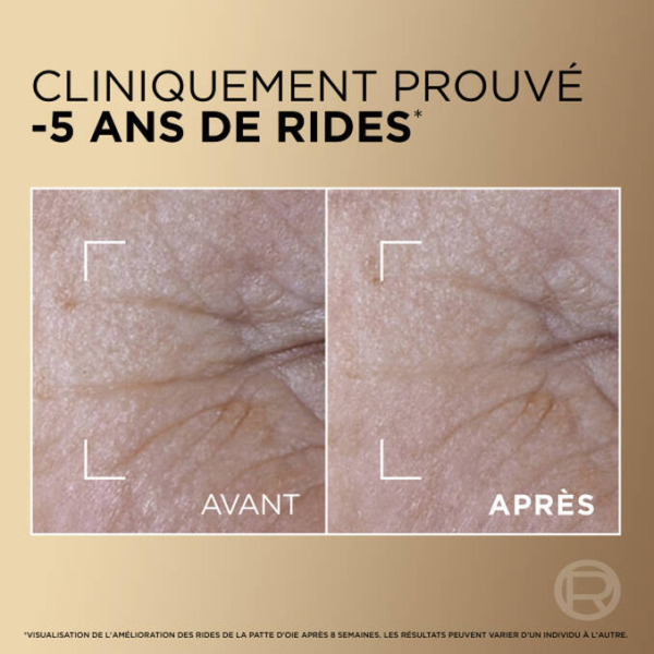 Comparaison rapprochée du contour des yeux : la gauche ("avant") montre plus de rides, la droite ("après") est plus lisse après avoir utilisé L'Oréal Age Perfect Sérum Anti-Âge Le Duo Fermeté Instantanée Anti-Rides et Éclat 30 ml. Texte : "cliniquement prouvé -5 ans de rides. Dakar