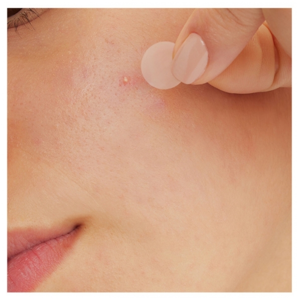 Un gros plan montre une personne appliquant avec ses doigts un patch anti-acné translucide CeraVe Patchs Anti Imperfections 22 Patchs sur une petite imperfection de la joue. Dakar