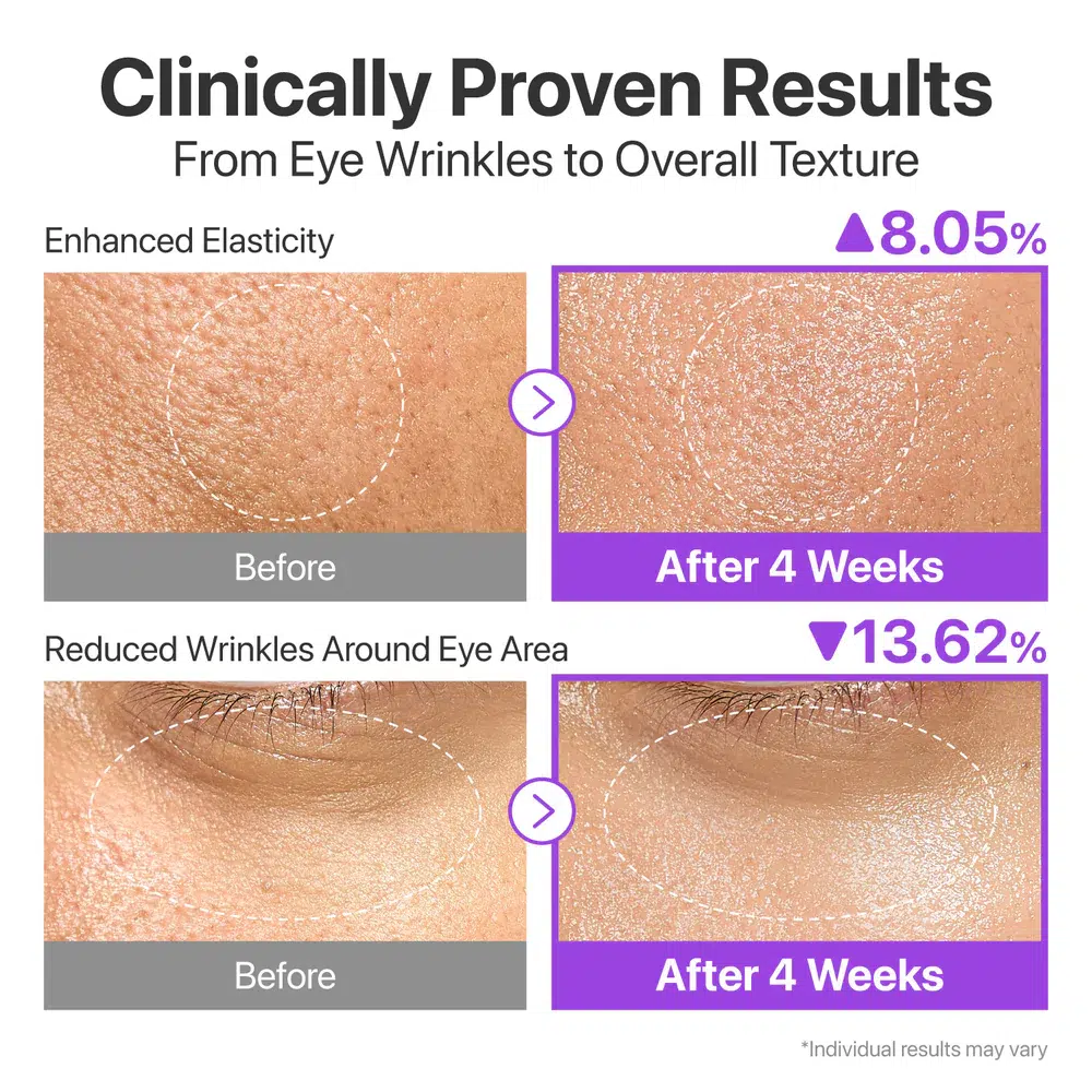 Des photos côte à côte en gros plan montrent la peau du visage avant et après 4 semaines de traitement, mettant en évidence l'amélioration de l'élasticité (8,05 %) et la réduction des rides des yeux (13,62 %). Le texte indique que les résultats peuvent varier. Dakar