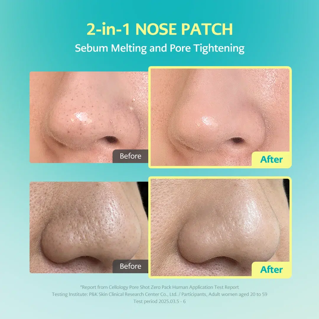 Jumiso Patch de Nuit Anti Imperfections et Pores Dilatés pour Nez 10 pièces – Image 3