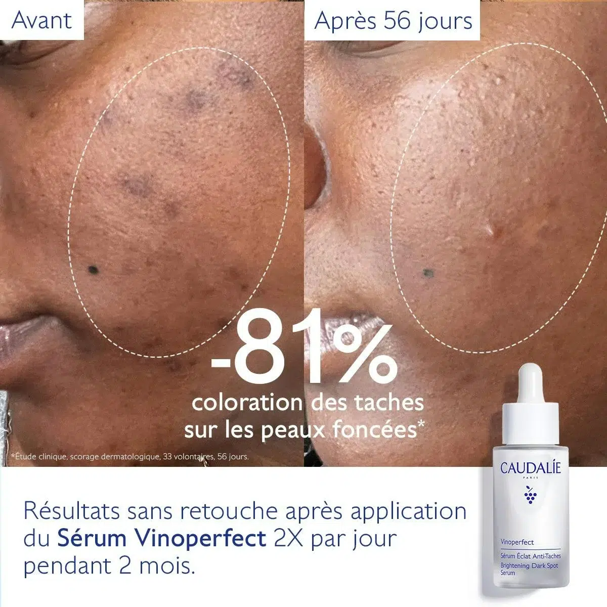 Caudalie Vinoperfect Coffret Anti-Taches Sérum 30 ml + Mousse Micro Peeling 50 ml – Image 2